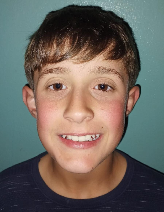 player img